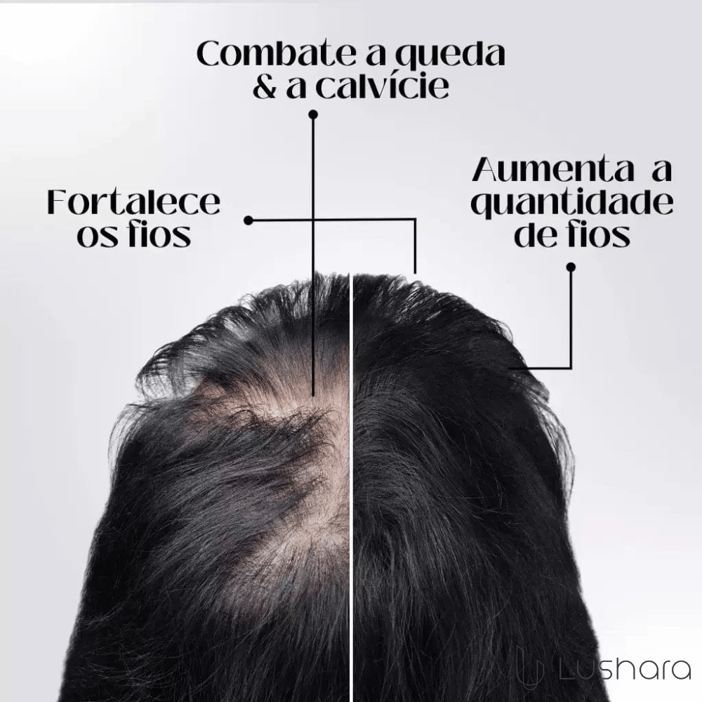 Kit Hair Revive®: Compre 1, Leve 3 Frascos de Óleo para Crescimento Capilar!