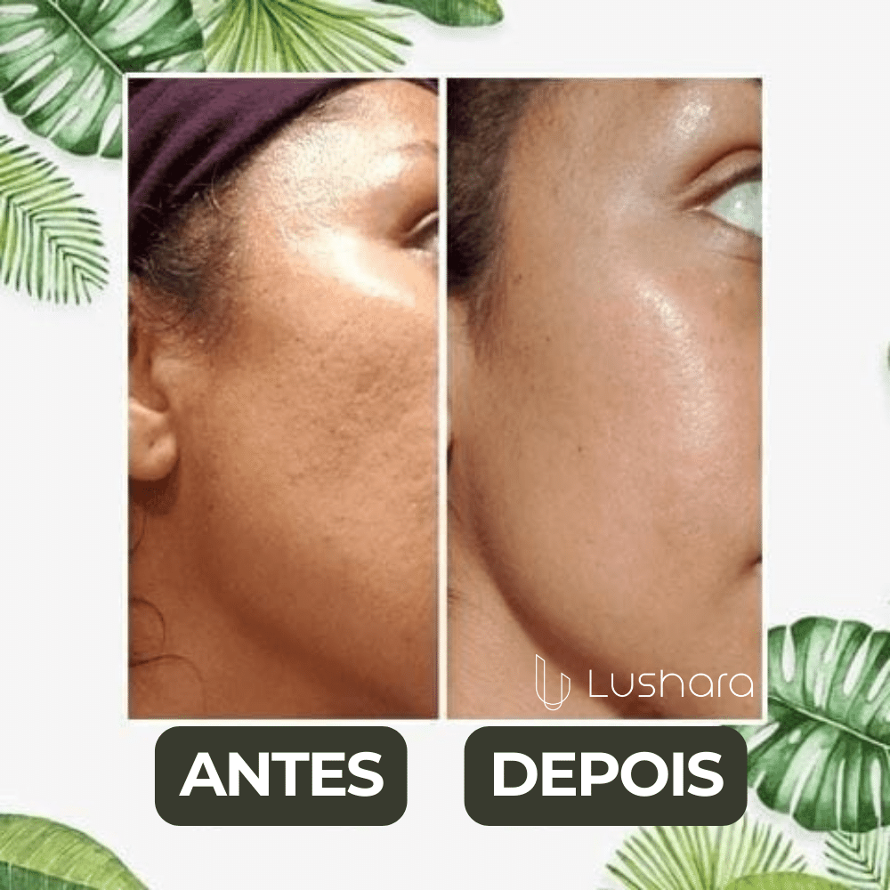 GreenMask® - Máscara Removedora para Cravos, Acne e Poros